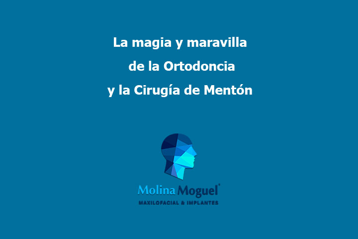 Cirug A Maxilofacial Maxilofacial Cdmx Dr Molina Moguel